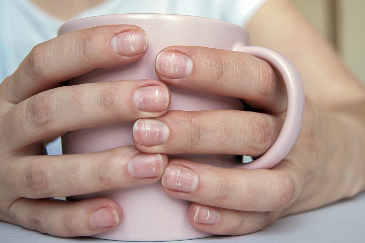 Close view of hands gripping a warm mug, an everyday moment when anxiety symptoms appear
